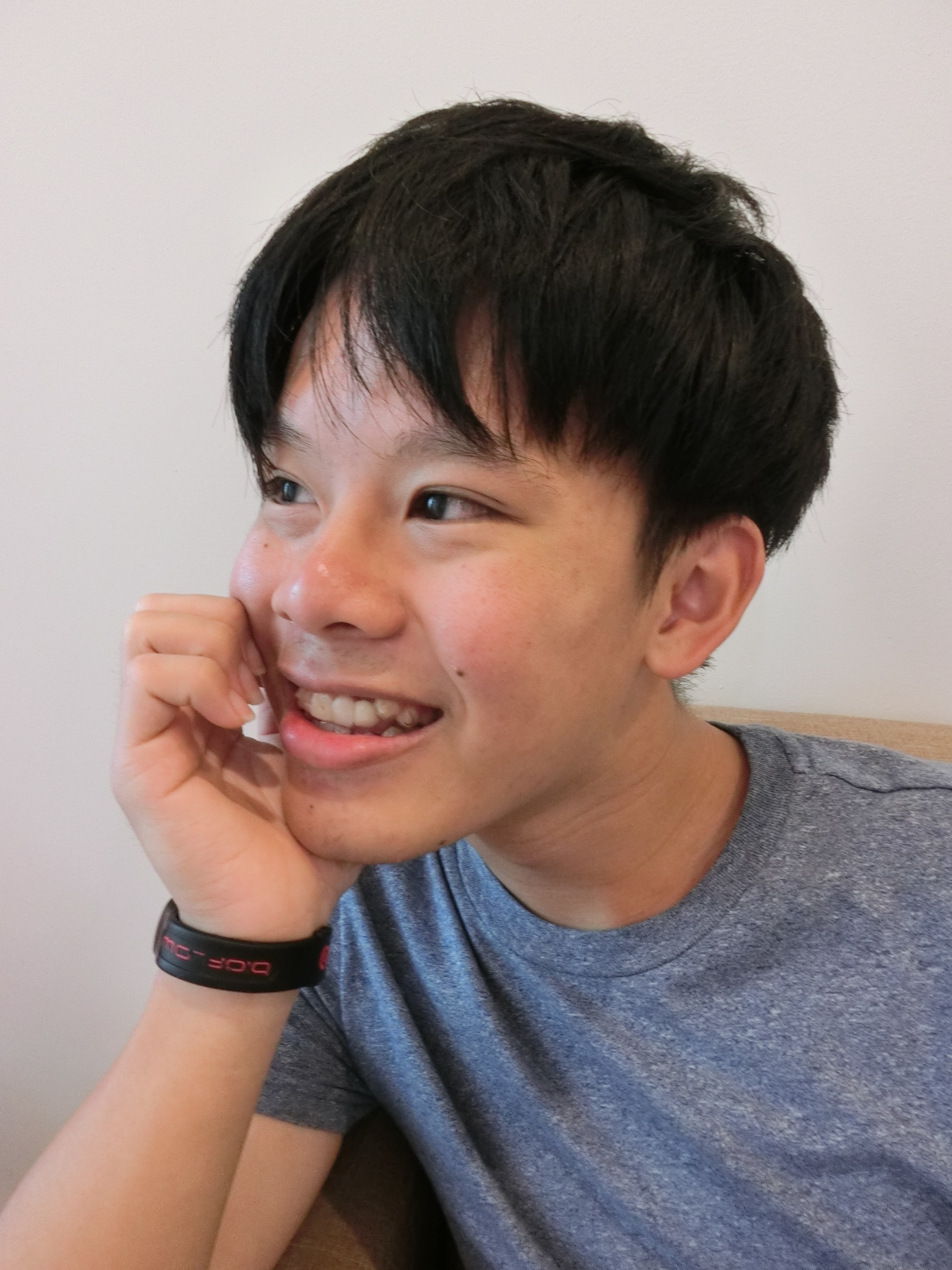 je-neo-invisalign-02