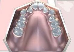 16730162_1232766283437524_908357892263166300_n