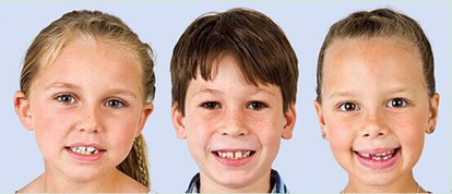 向不良口腔习惯Say NO ⚠⚠