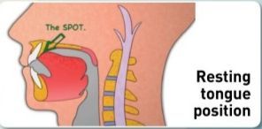 mrc-myobrace-beginner-course-2014-part-3-78-638