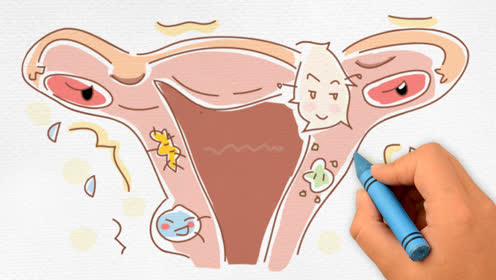 AGNES LEESY AIA LADY INCOME REPLACEMENT 职业女性收入替代 女性疾病