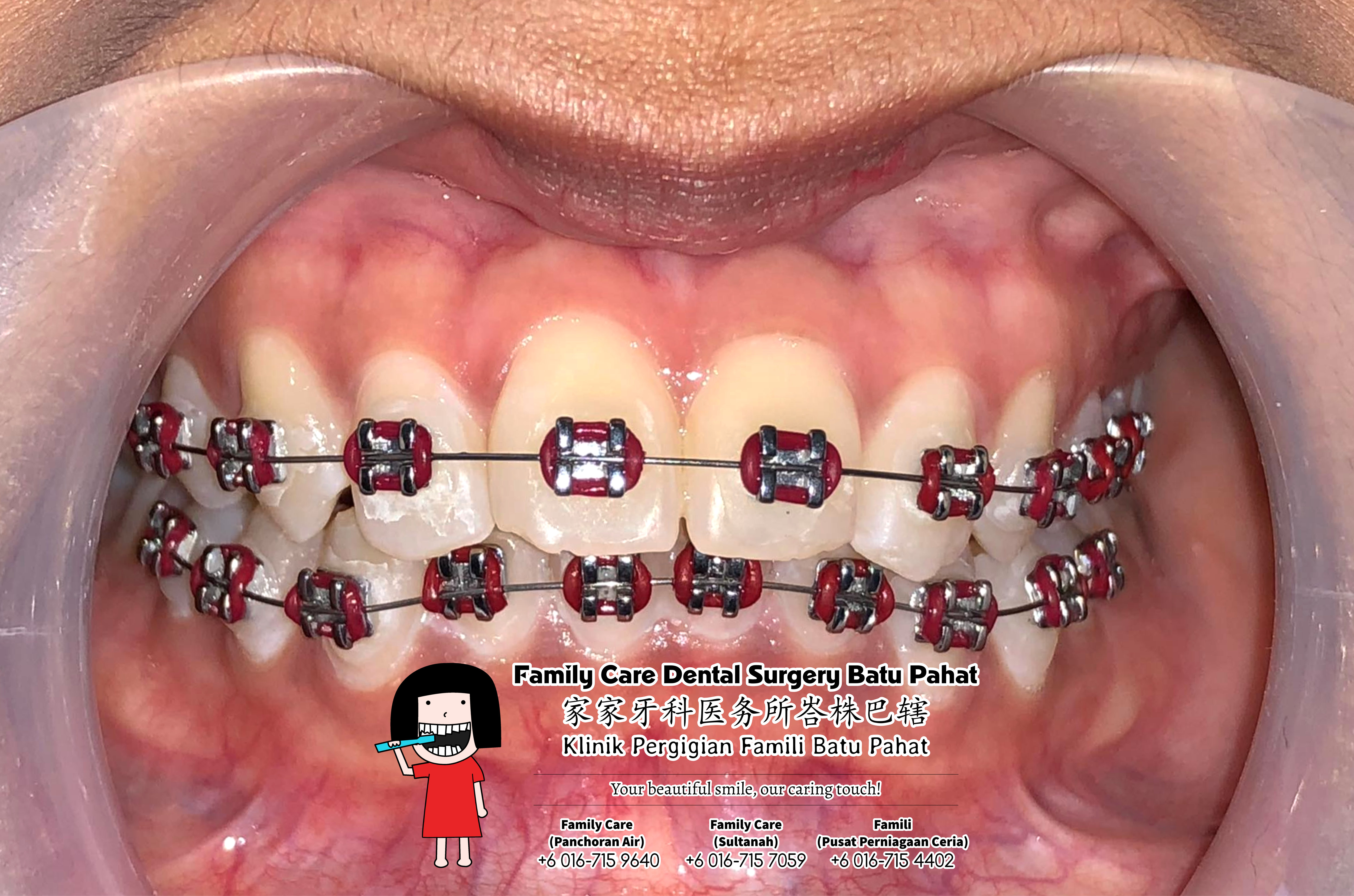 Klinik Pergigian Famili Batu Pahat Johor Malaysia Batu Pahat Doktor Pergigian Kanak-kanak Klinik Pergigian Perkhidmatan Komuniti Ke Sekolah Tinggi Cina Batu Pahat Memeriksa Gigi Pelajar A05-01
