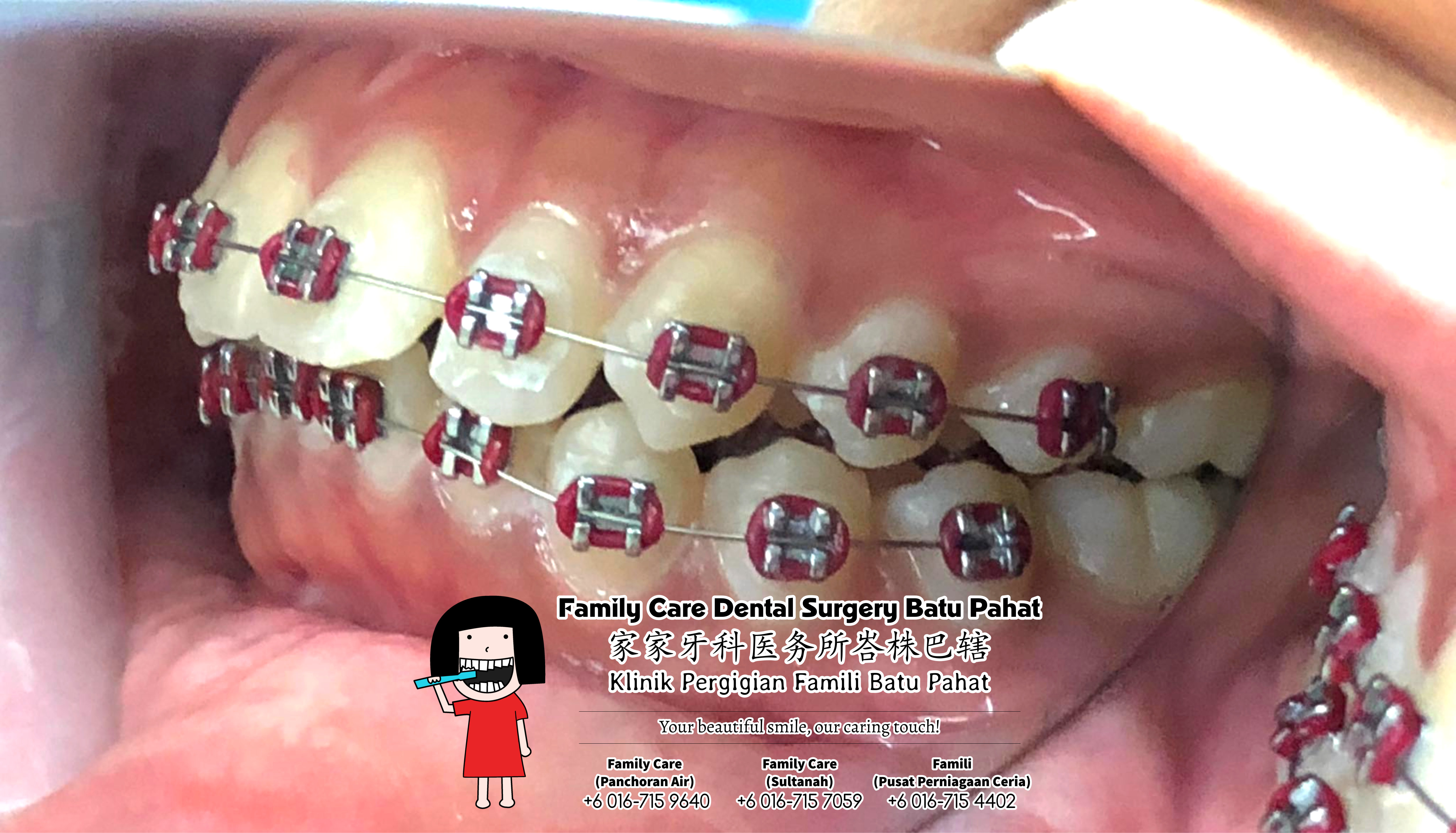 Klinik Pergigian Famili Batu Pahat Johor Malaysia Batu Pahat Doktor Pergigian Kanak-kanak Klinik Pergigian Perkhidmatan Komuniti Ke Sekolah Tinggi Cina Batu Pahat Memeriksa Gigi Pelajar A05-01