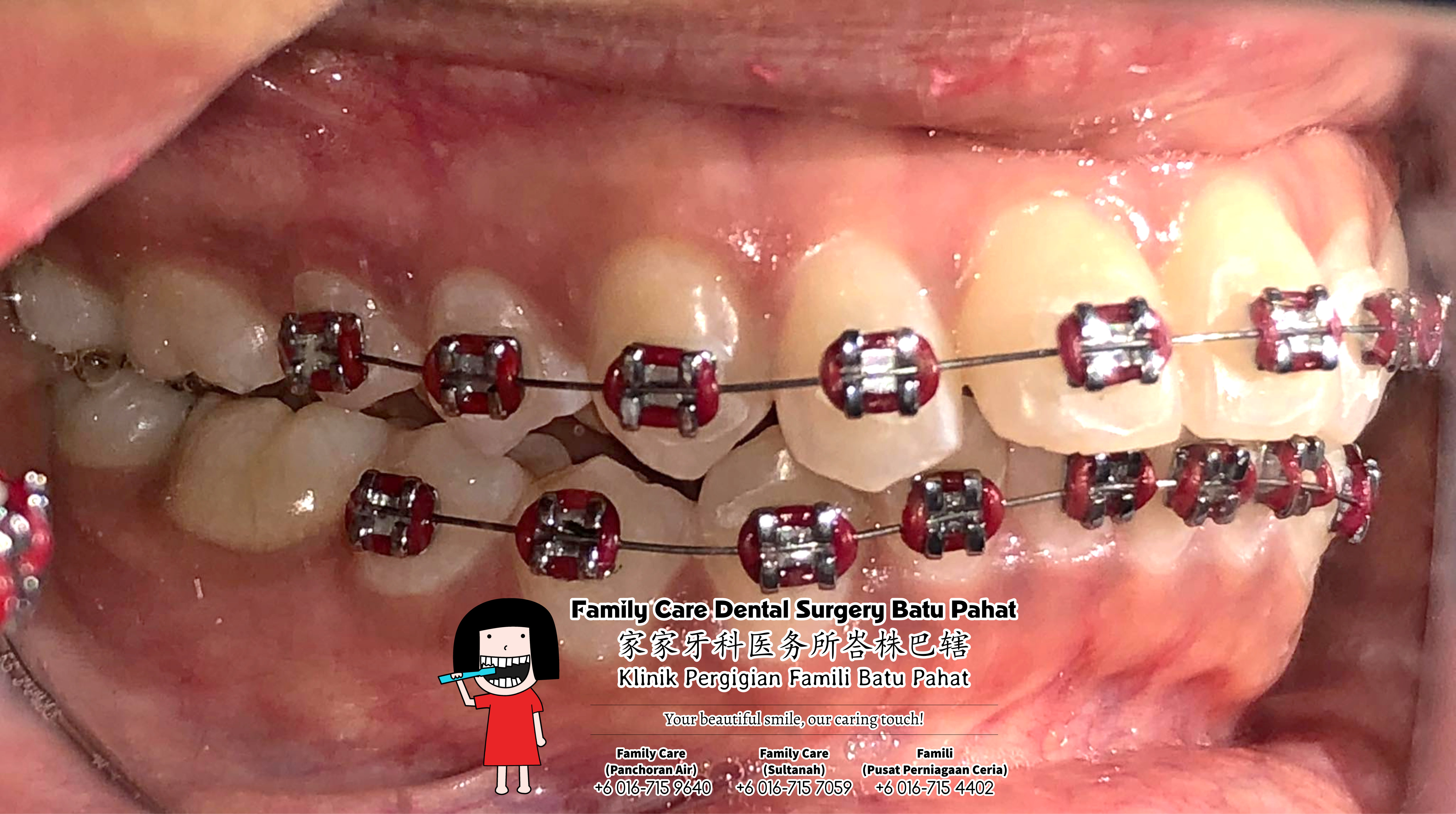 Klinik Pergigian Famili Batu Pahat Johor Malaysia Batu Pahat Doktor Pergigian Kanak-kanak Klinik Pergigian Perkhidmatan Komuniti Ke Sekolah Tinggi Cina Batu Pahat Memeriksa Gigi Pelajar A05-01